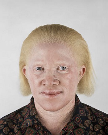 Негры-альбиносы (11 фото)