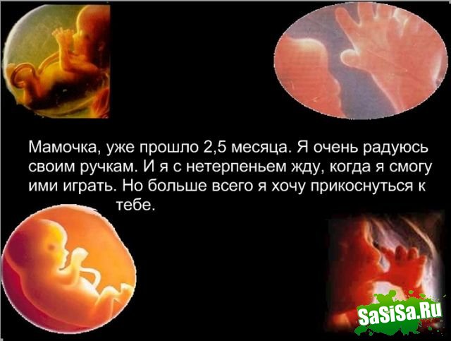 Социалка против абортов - очень грустно! (14 фото)