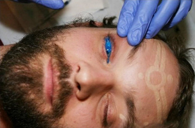 Жуткая процедура — тату на глазах (4 фото)
