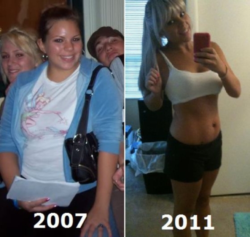 Шокирующе похудевшие девушки (27 фото)