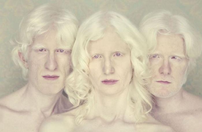 Удивительные люди-альбиносы (15 фото)