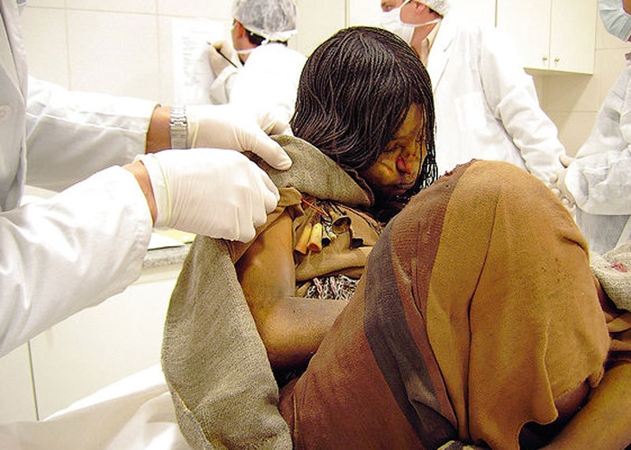 Ученые изучают мумию девочки из племени инков (6 фото)