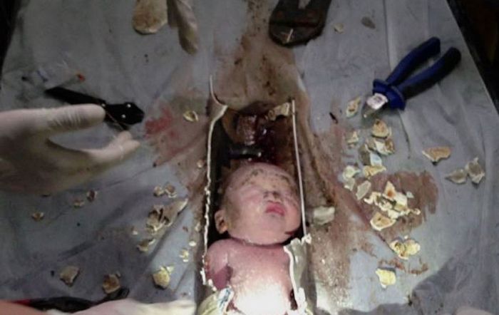 В Китае спасли новорожденного, которого смыли в унитаз (10 фото)