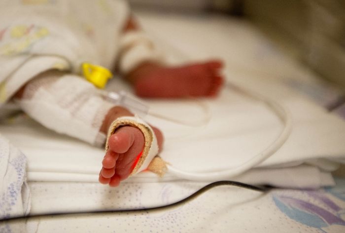 Репортаж из отделения реанимации новорожденных (20 фото)